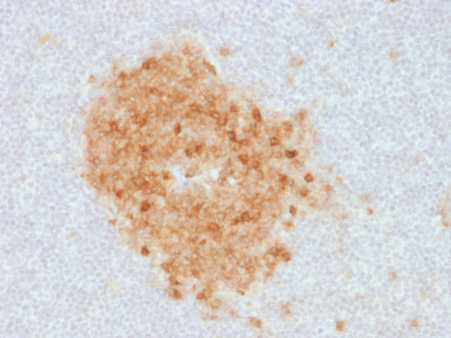 CD10 (Membrane Metalloendopeptidase) Antibody in Immunohistochemistry (Paraffin) (IHC (P))