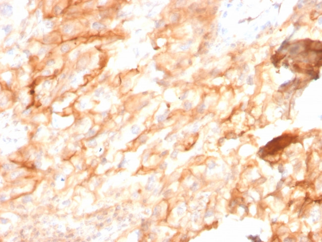 CD10 (Membrane Metalloendopeptidase) Antibody in Immunohistochemistry (Paraffin) (IHC (P))