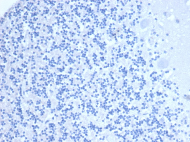 CD10 (Membrane Metalloendopeptidase) Antibody in Immunohistochemistry (Paraffin) (IHC (P))