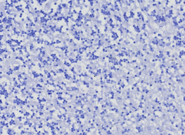 CD10 (Membrane Metalloendopeptidase) Antibody in Immunohistochemistry (Paraffin) (IHC (P))