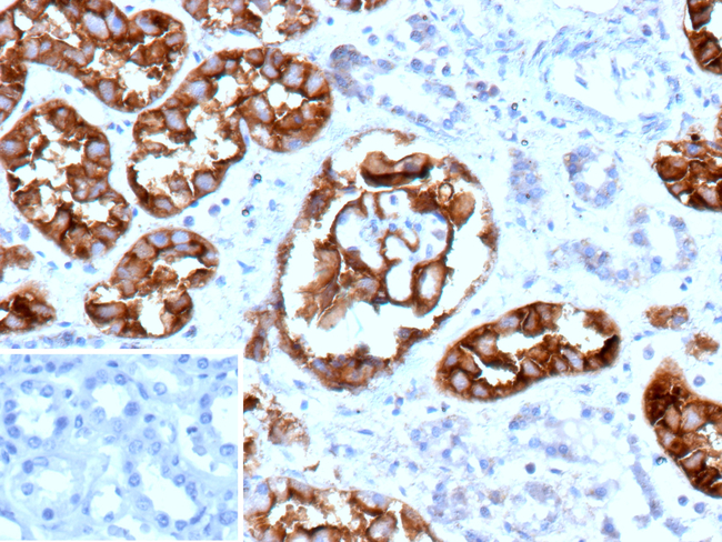 CD10 (Membrane Metalloendopeptidase) Antibody in Immunohistochemistry (Paraffin) (IHC (P))