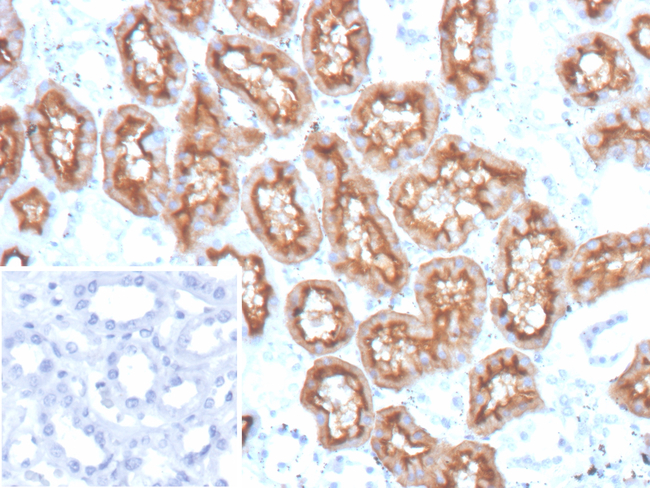 CD10 (Membrane Metalloendopeptidase) Antibody in Immunohistochemistry (Paraffin) (IHC (P))