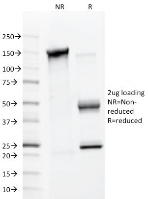 MMP2/Collagenase Type IV A (Tumor Metastasis Marker) Antibody in SDS-PAGE (SDS-PAGE)