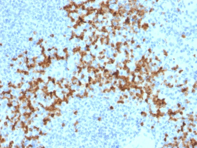MMP9 (Matrix Metalloproteinase 9) Antibody in Immunohistochemistry (Paraffin) (IHC (P))