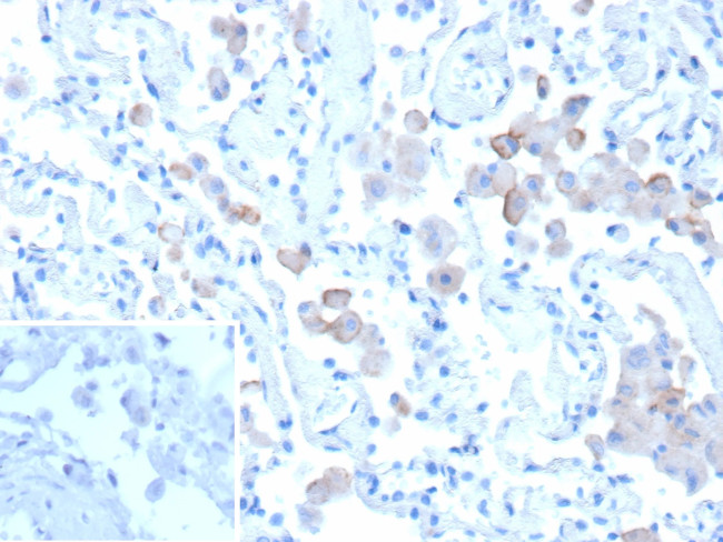 Mannose Receptor/CD206 Antibody in Immunohistochemistry (Paraffin) (IHC (P))