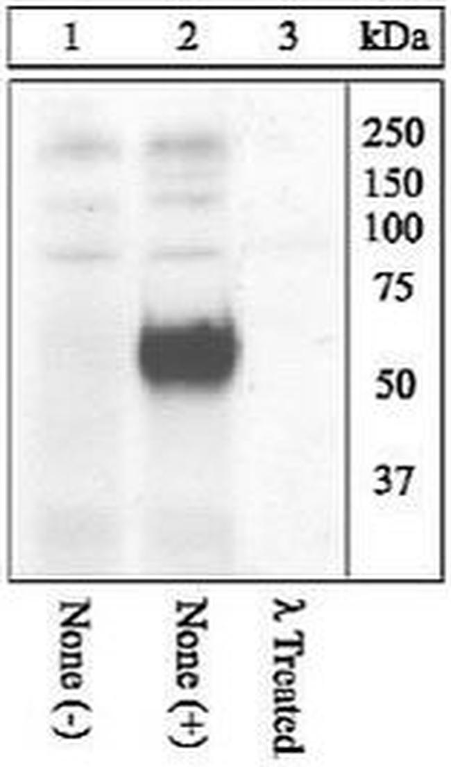 Phospho-c-Fos (Thr325) Antibody