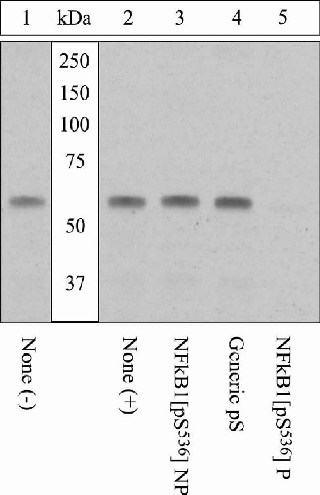 Phospho-NFkB p65 (Ser536) Antibody in Western Blot (WB)
