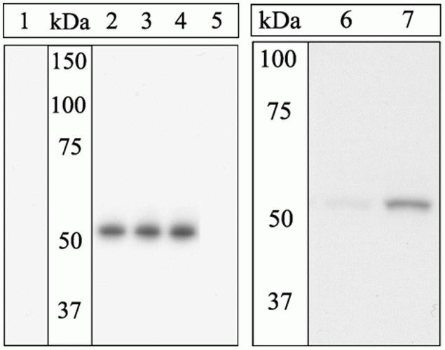 Phospho-ETS1 (Ser282) Antibody in Western Blot (WB)
