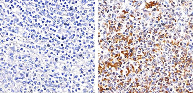Phospho-Btk (Tyr551) Antibody in Immunohistochemistry (Paraffin) (IHC (P))