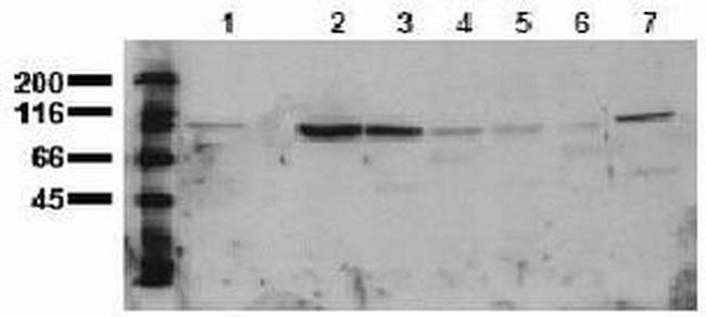 beta Catenin Antibody in Western Blot (WB)