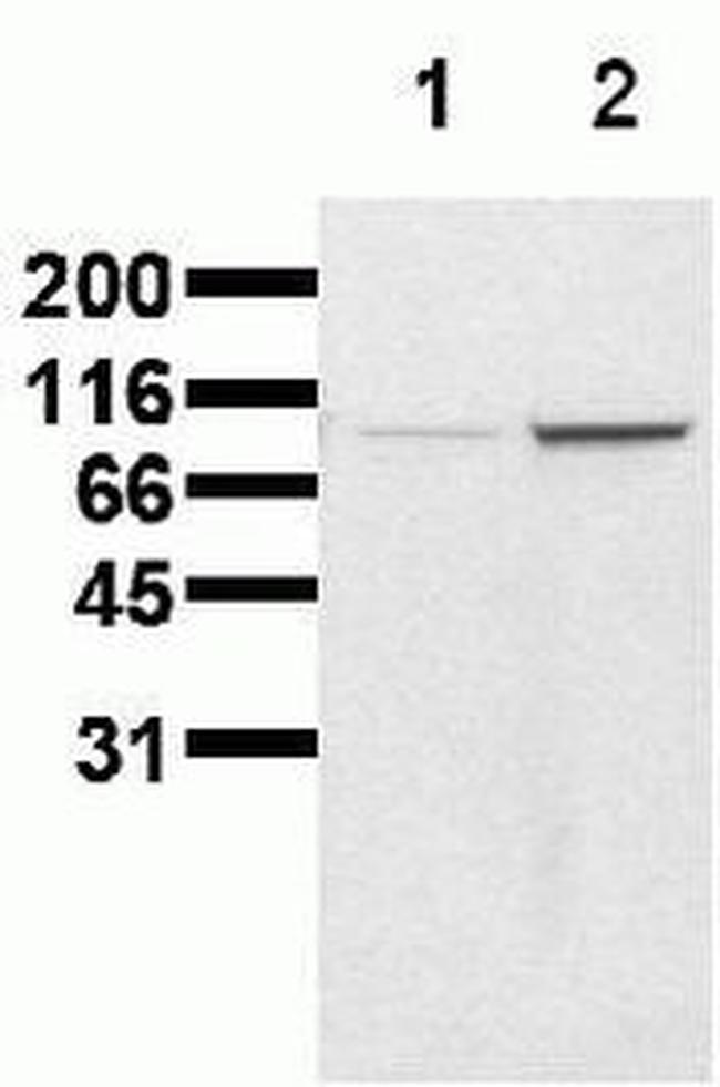 Phospho-beta Catenin (Ser86) Antibody in Western Blot (WB)