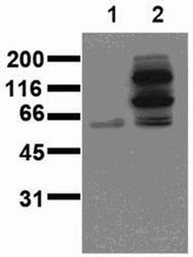 Phospho-beta Catenin (Tyr654, Tyr643) Antibody in Western Blot (WB)