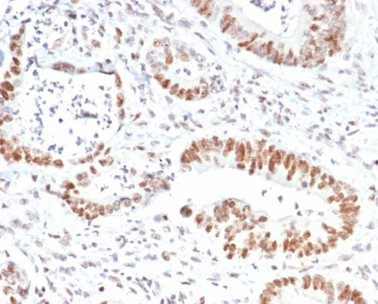 MSH2 (DNA Mismatch Repair Marker) Antibody in Immunohistochemistry (Paraffin) (IHC (P))