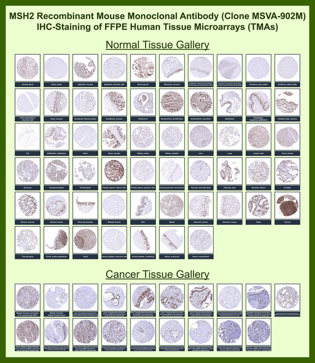 MSH2 (DNA Mismatch Repair Marker) Antibody in Immunohistochemistry (Paraffin) (IHC (P))