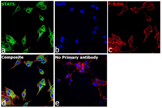 STAT5 alpha/beta Antibody in Immunocytochemistry (ICC/IF)