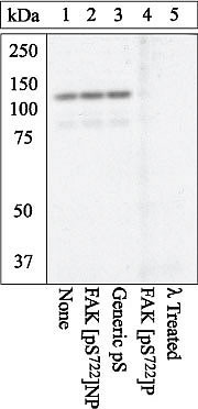 Phospho-FAK (Ser722) Antibody in Western Blot (WB)