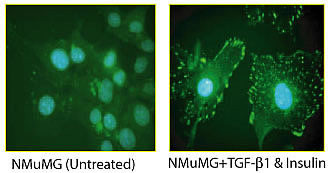 Phospho-PYK2 (Tyr402) Antibody in Immunocytochemistry (ICC/IF)