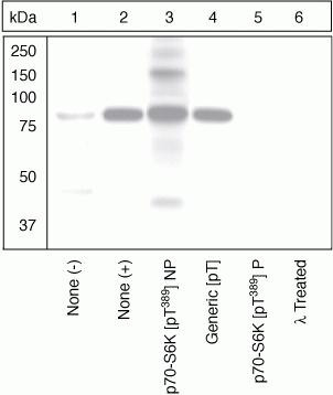 Phospho-p70 S6 Kinase (Thr389) Antibody in Western Blot (WB)