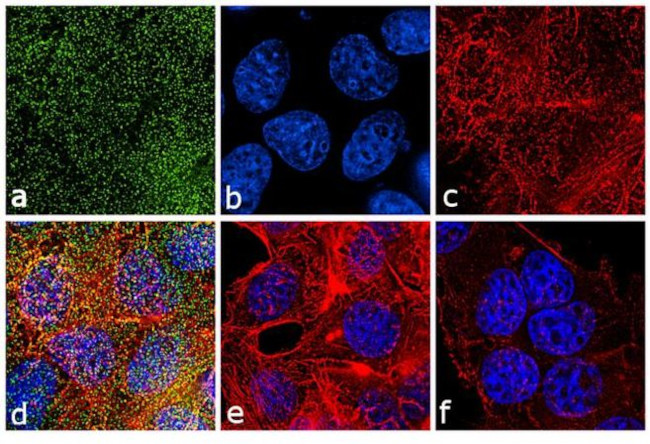 Phospho-PKC alpha (Thr638) Antibody in Immunocytochemistry (ICC/IF)