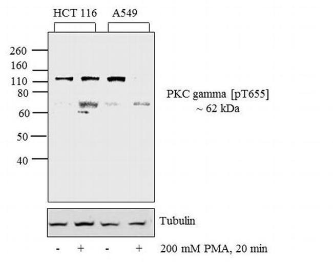 Phospho-PKC gamma (Thr655) Antibody in Western Blot (WB)