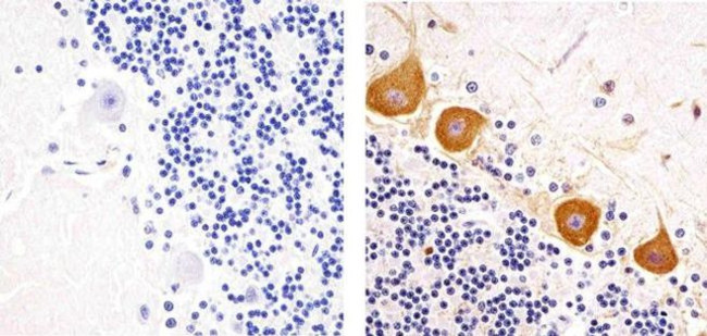 Phospho-PKC gamma (Thr655) Antibody in Immunohistochemistry (Paraffin) (IHC (P))