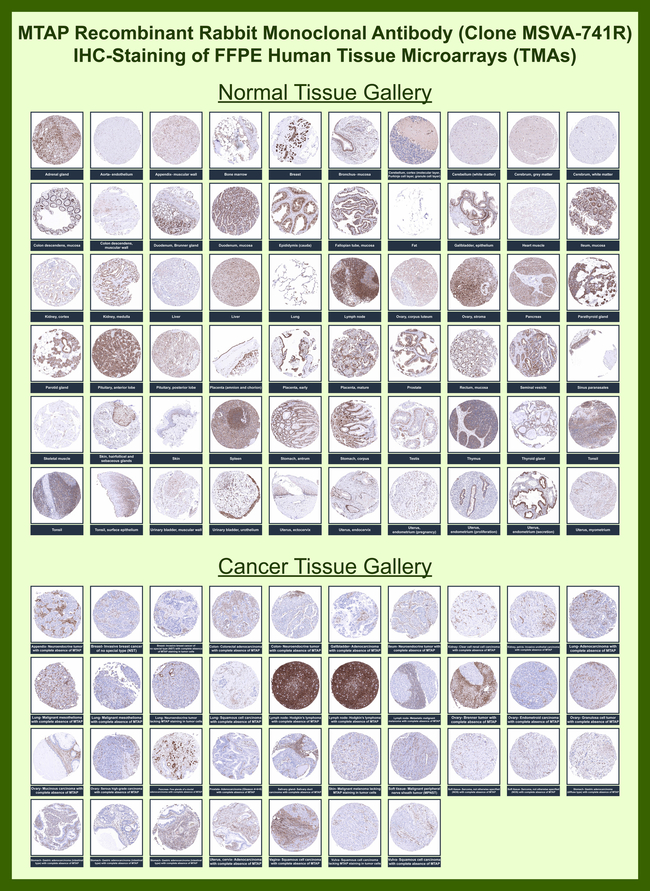 MTAP (Tumor Suppressor Marker) Antibody in Immunohistochemistry (Paraffin) (IHC (P))