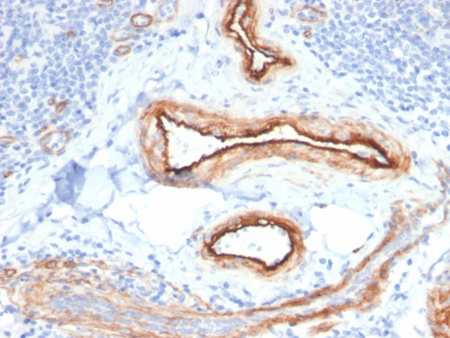 MTF1 Antibody in Immunohistochemistry (Paraffin) (IHC (P))