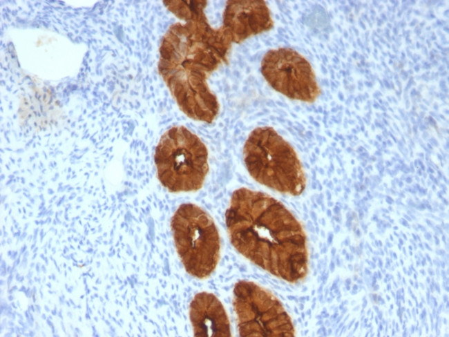 MUC1/CA15-3/EMA/CD227 Antibody in Immunohistochemistry (Paraffin) (IHC (P))