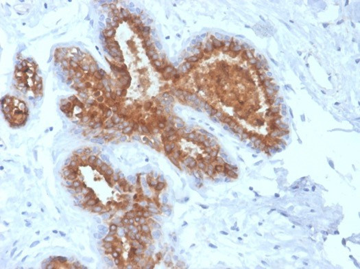 MUC1/CA15-3/EMA/CD227 (Epithelial Marker) Antibody in Immunohistochemistry (Paraffin) (IHC (P))