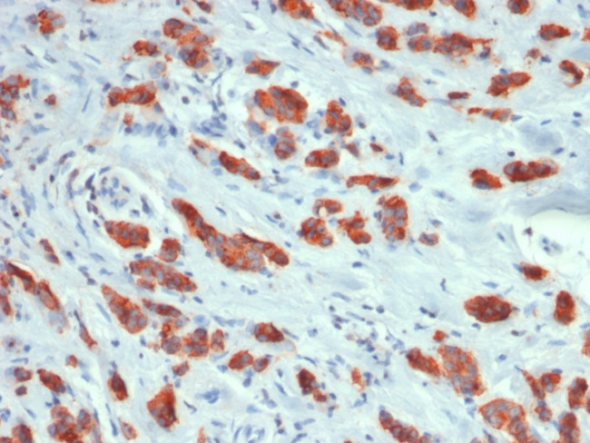 MUC1/CA15-3/EMA/CD227 Antibody in Immunohistochemistry (Paraffin) (IHC (P))