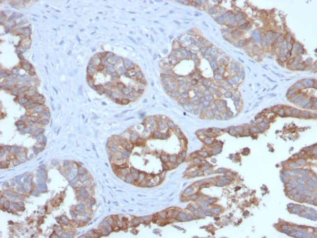 MUC1/CA15-3/EMA/CD227 (Epithelial Marker) Antibody in Immunohistochemistry (Paraffin) (IHC (P))
