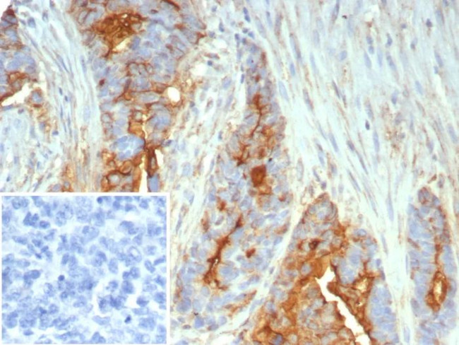 MUC1/CA15-3/EMA/CD227 (Epithelial Marker) Antibody in Immunohistochemistry (Paraffin) (IHC (P))