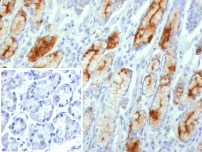 MUC1/CA15-3/EMA/CD227 (Epithelial Marker) Antibody in Immunohistochemistry (Paraffin) (IHC (P))