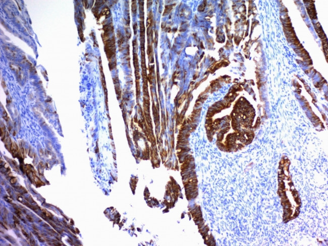 MUC2 (Mucin 2) Antibody in Immunohistochemistry (Paraffin) (IHC (P))