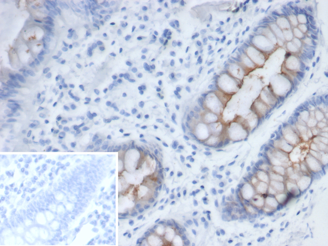 MUC4 (Mucin 4/Gastric Mucin) Antibody in Immunohistochemistry (Paraffin) (IHC (P))