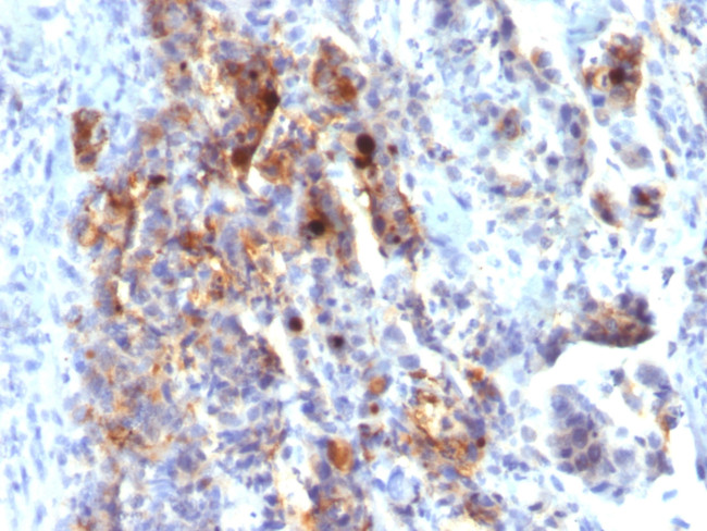MUC5AC (Mucin 5AC/Gastric Mucin) Monoclonal Antibody (45M1), Biotin ...
