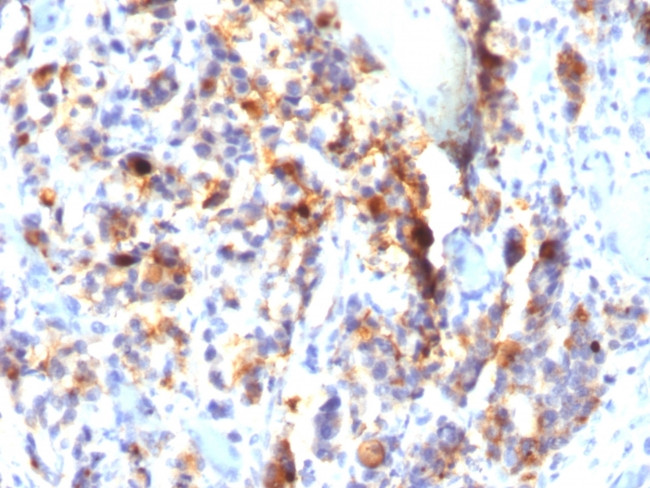 MUC5AC (Mucin 5AC/Gastric Mucin) Antibody in Immunohistochemistry (Paraffin) (IHC (P))