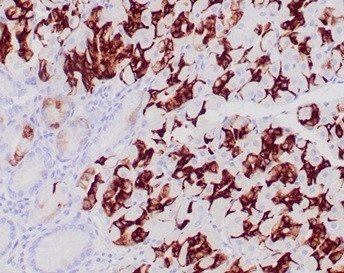 MUC6 (Mucin 6/Gastric Mucin) Antibody in Immunohistochemistry (Paraffin) (IHC (P))