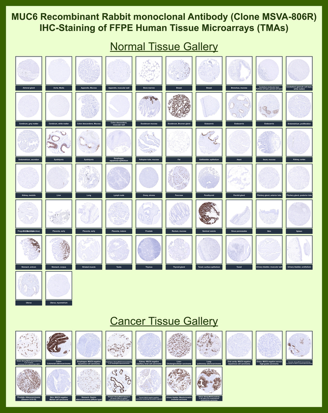 MUC6 (Mucin 6/Gastric Mucin) Antibody in Immunohistochemistry (Paraffin) (IHC (P))