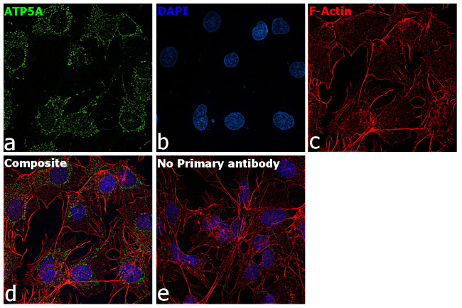 ATP5H Antibody in Immunocytochemistry (ICC/IF)