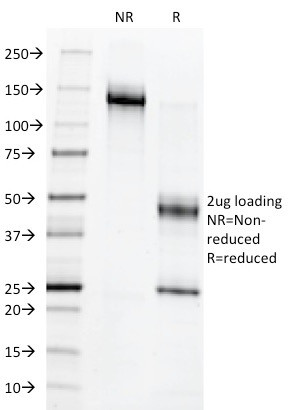 c-Myb Oncoprotein Antibody in SDS-PAGE (SDS-PAGE)