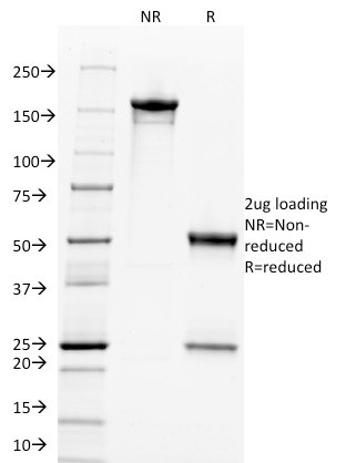 c-Myc Oncoprotein Antibody in SDS-PAGE (SDS-PAGE)