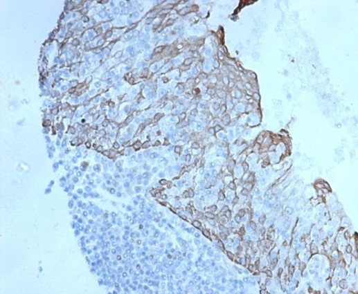 c-Myc Oncoprotein Antibody in Immunohistochemistry (Paraffin) (IHC (P))