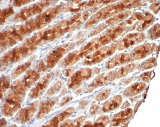 c-Myc Oncoprotein Antibody in Immunohistochemistry (Paraffin) (IHC (P))