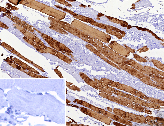 MYH7 Antibody in Immunohistochemistry (Paraffin) (IHC (P))