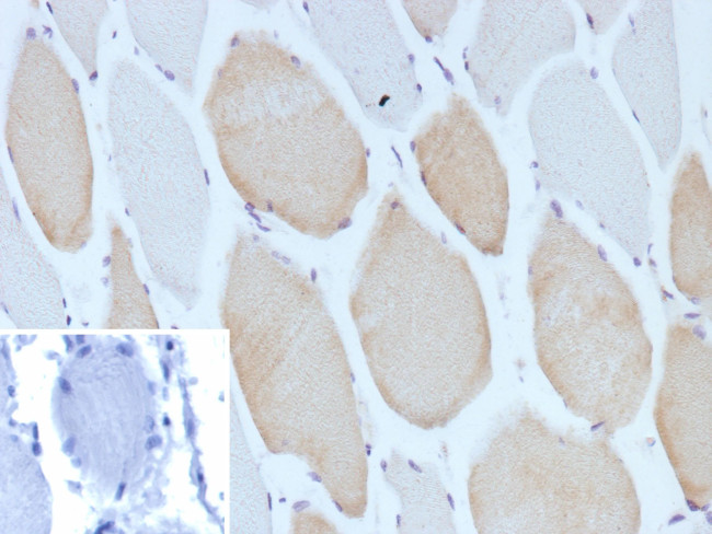 MYH7 Antibody in Immunohistochemistry (Paraffin) (IHC (P))