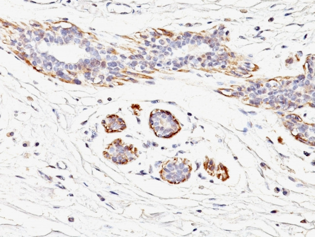 Smooth Muscle Myosin Heavy Chain (SM-MHC) Antibody in Immunohistochemistry (Paraffin) (IHC (P))