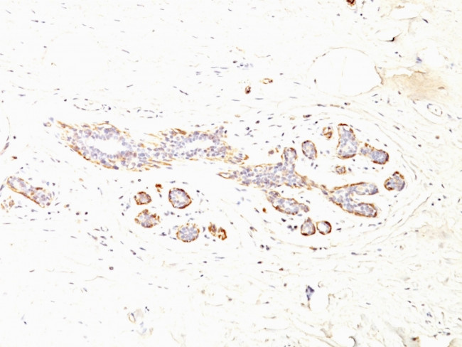 Smooth Muscle Myosin Heavy Chain (SM-MHC) Antibody in Immunohistochemistry (Paraffin) (IHC (P))