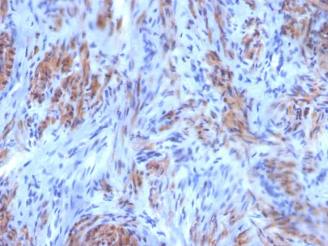 Smooth MuscleMyosin Heavy Chain (SM-MHC) (Leiomyosarcoma and Myoepithelial Cell Marker) Antibody in Immunohistochemistry (Paraffin) (IHC (P))