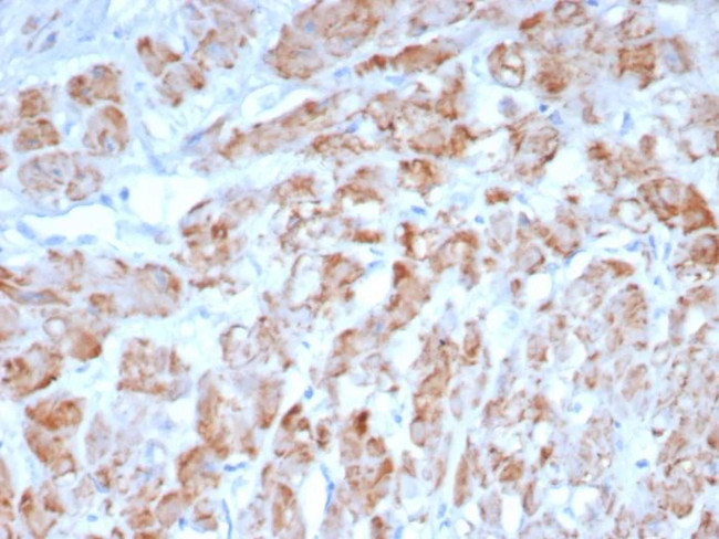 Smooth Muscle Myosin Heavy Chain (SM-MHC) (Leiomyosarcoma and Myoepithelial Cell Marker) Antibody in Immunohistochemistry (Paraffin) (IHC (P))